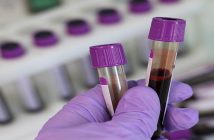 bloodtest_oncology news australia