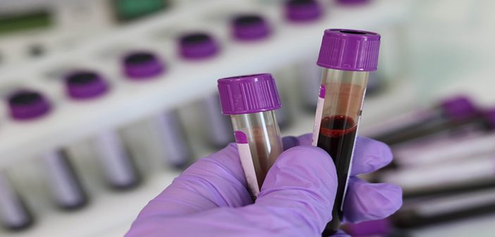 bloodtest_oncology news australia