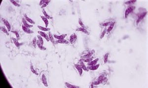400px-Toxoplasmosis2