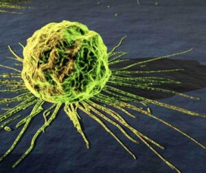 cancer cells oncology news australia