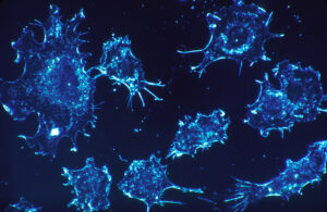Cancer_cells_oncology news australia