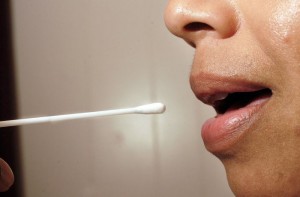 Cheek Swab_oncology news australia