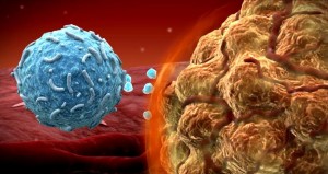 FDA approves melanoma drug_UCLA