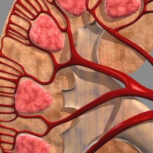Kidney Cross Close up