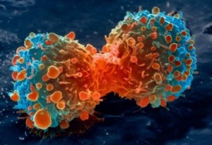 Lung Cancer