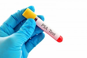 PSA test concept_oncology news australia
