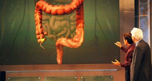 ONA Precancerous Colorectal Tumors
