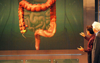 ONA Precancerous Colorectal Tumors