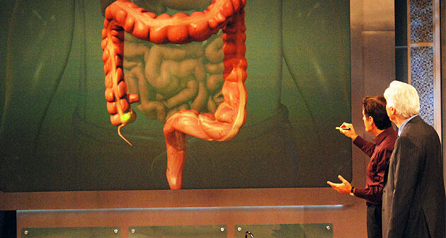 ONA Precancerous Colorectal Tumors