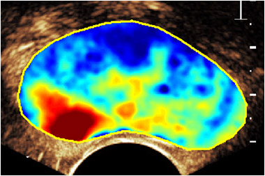 Prostate image generated with new technique
