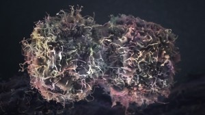 Skin cancer cell