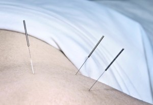 acupuncture_oncology news australia_800x500
