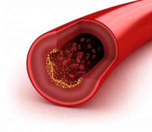 artery_oncology news australia