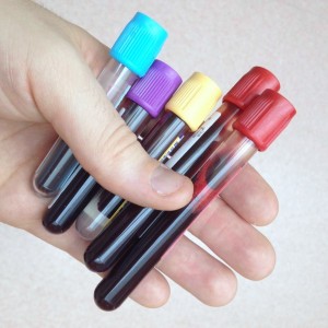 blood test_oncology news australia