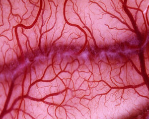 blood vessels oncologynewscomau