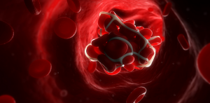 blot clot_oncology news australia