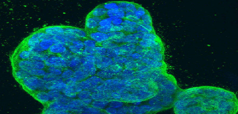 First epigenetic study in 3D human cancer cells