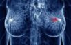 Oncology News Australia