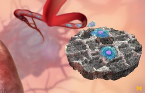 cancer-decoy-could-attract-capture-malignant-cells-orig-20150910