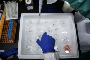 cancer-decoy-could-attract-capture-malignant-cells-orig2-20150910