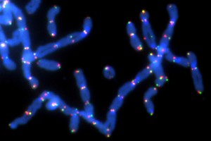 chromosomes_oncology news australia