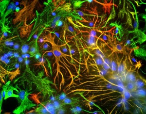 glial cells