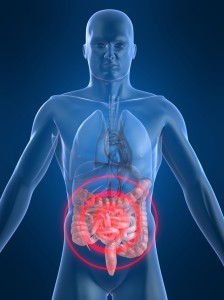 inflammation of colon_oncology news australia
