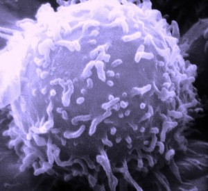 lymphocyte_wikipedia_800x700