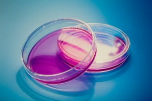 petri dishes
