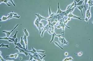 Prostate Cancer cells