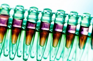 Laboratory research of cancer diseases,  rack with RNA samples