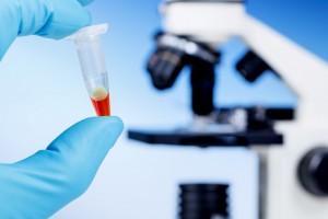 research microscope vial_oncology news australia