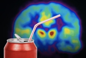 sugar brain scan concept_oncology news australia