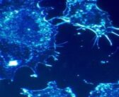 Tiny sensors with the power to detect cancer