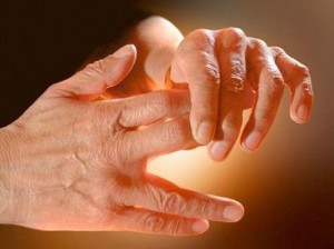 tingling hands nerve pain damage neuropathy_oncology news australia